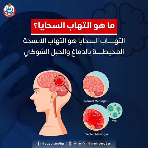 تقرير يكشف عن 259 ألف وفاة بسبب التهاب السحايا في 2023 والعقبات تعرقل تحقيق أهداف القضاء عليه
