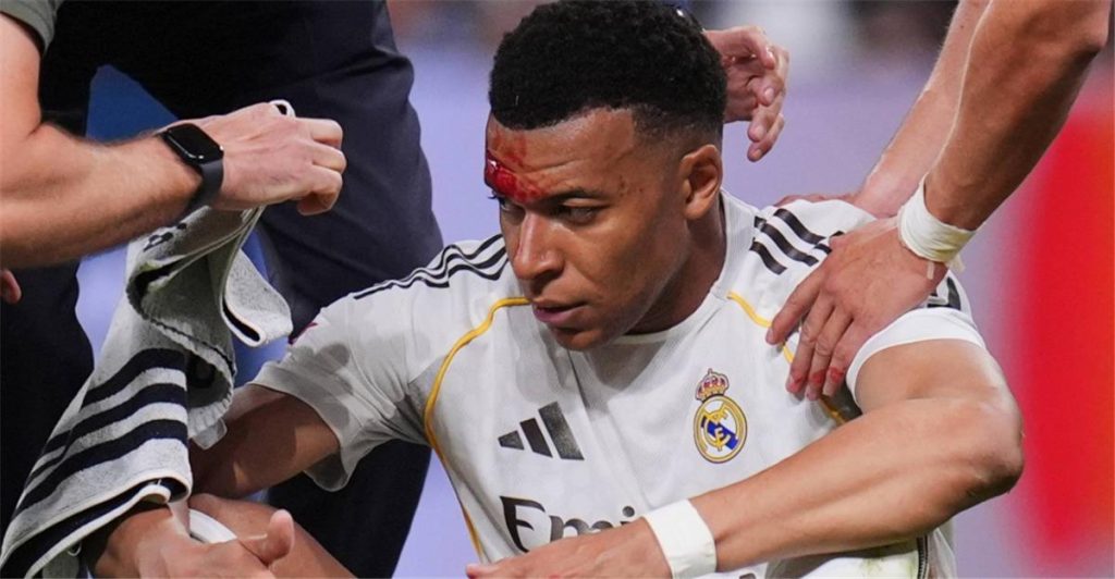 تدبير احترازي لحماية مبابي في مواجهة ريال مدريد وبايرن ميونخ